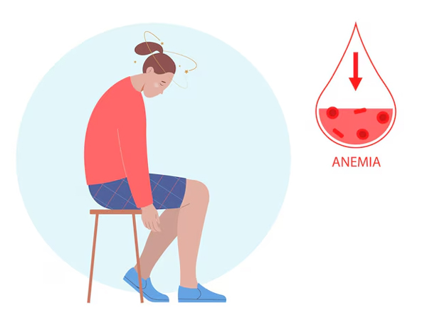 Anemia
