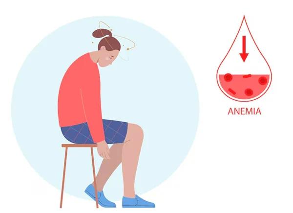 Anemia